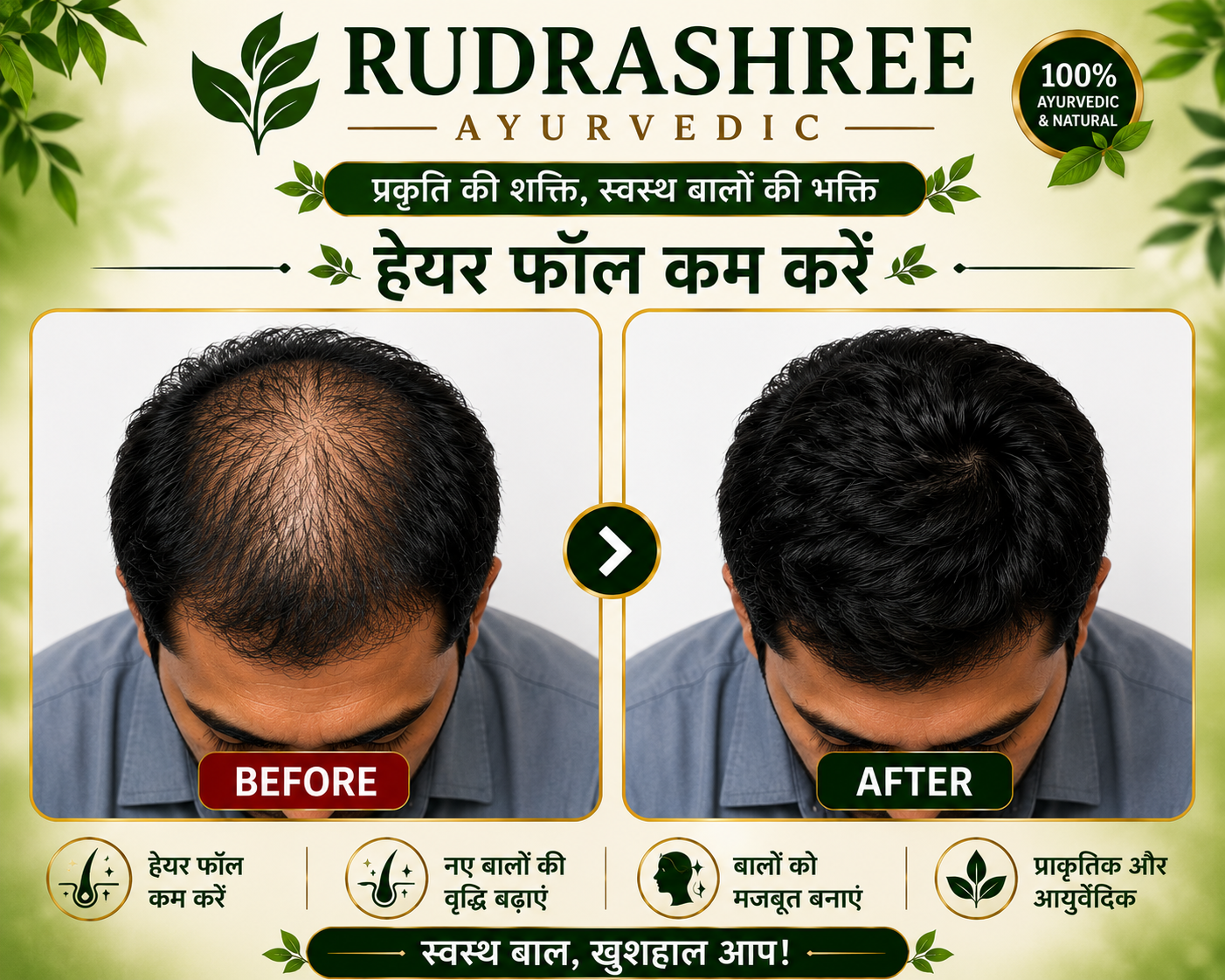 Rudrashree Ayurvedic Hair Oil & Shampoo Combo – Hair Fall Control, Hair Growth & Deep Scalp Nourishment