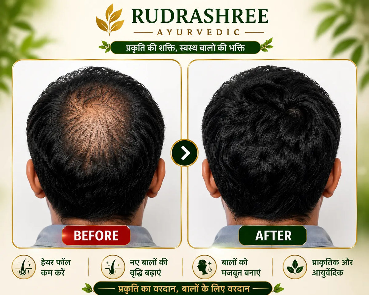 Rudrashree Ayurvedic Hair Oil & Shampoo Combo – Hair Fall Control, Hair Growth & Deep Scalp Nourishment