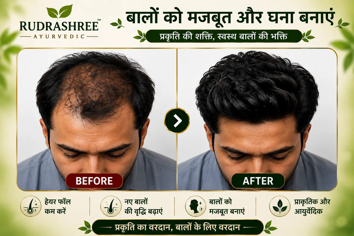 Rudrashree Ayurvedic Hair Oil & Shampoo Combo – Hair Fall Control, Hair Growth & Deep Scalp Nourishment