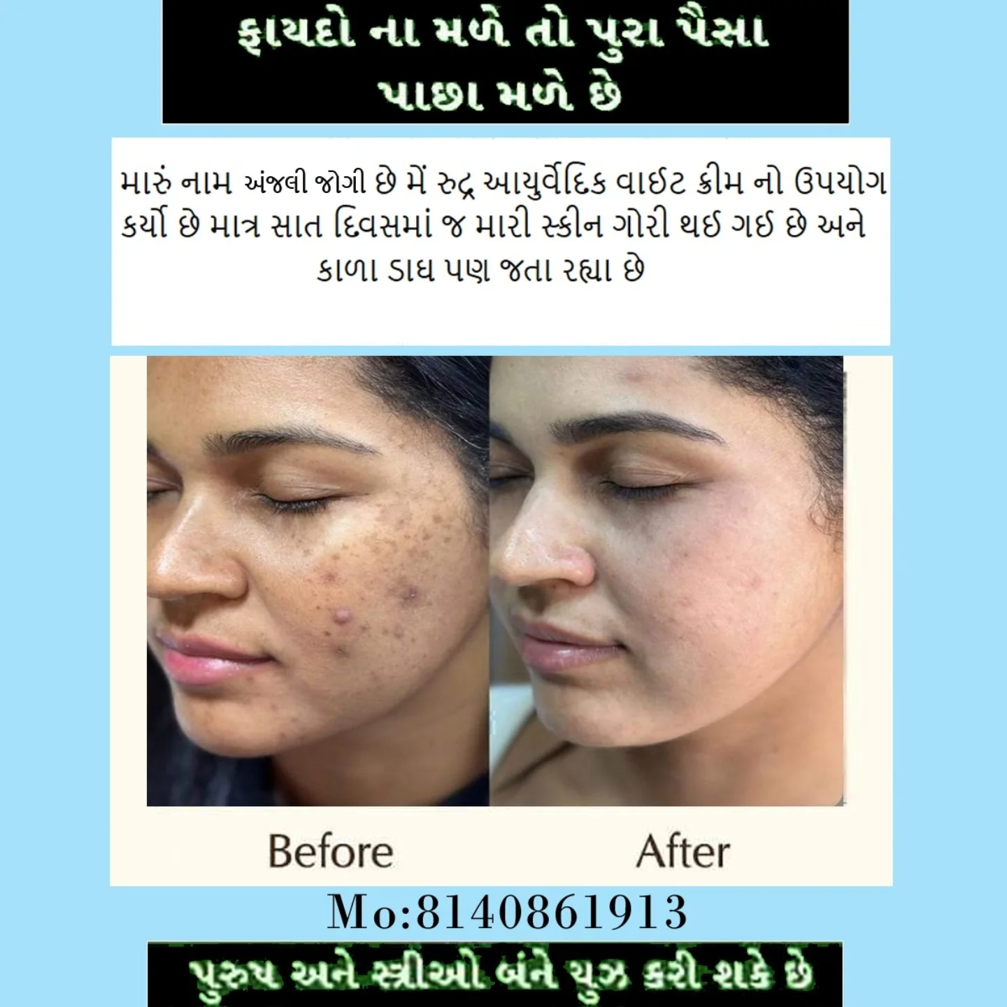 Before & After result