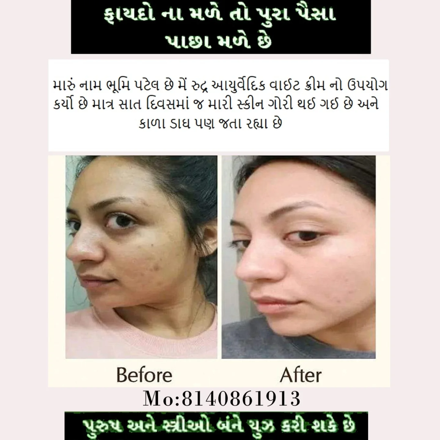 Before & After result