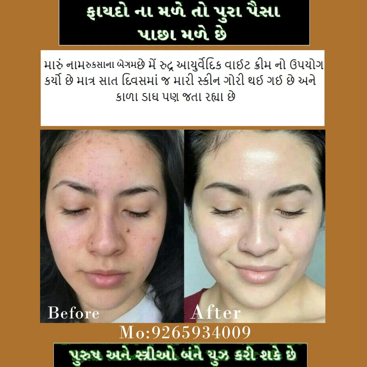 Before & After result